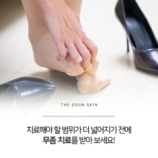 무좀은 관리와 치료가 복합적으로 병행되어야 합니다.