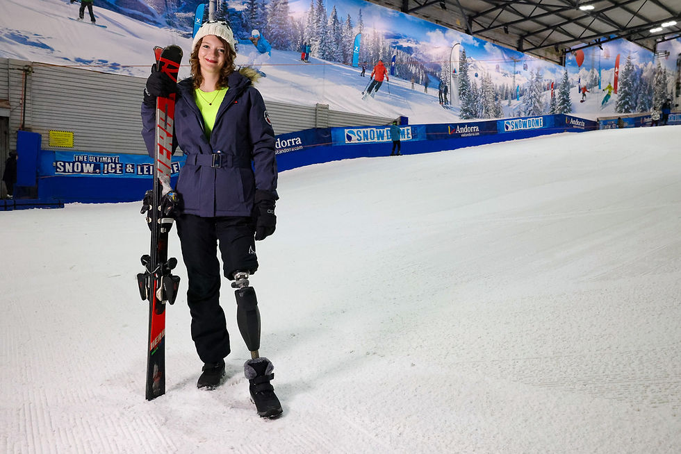 A person in ski gear holds skis in an indoor snow park. They have a prosthetic leg, smiling. Background shows snowy murals and "SNOWDOME" text.