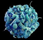 hiv belirtileri