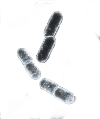 virüs