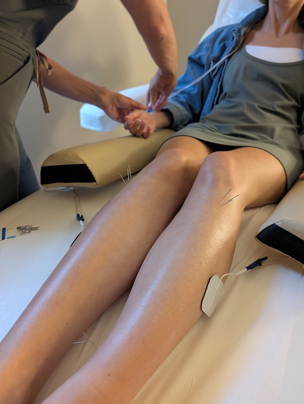 Acupuncture needles in knees to promote healing