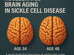 envejecimiento cerebral acelerado