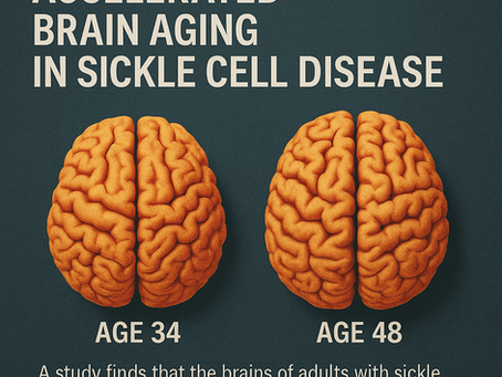 envejecimiento cerebral acelerado