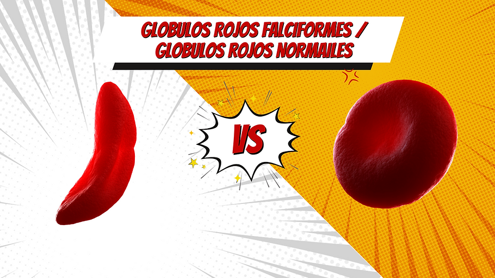 Glóbulos Rojos Falciformes vs. Glóbulos Rojos Normales