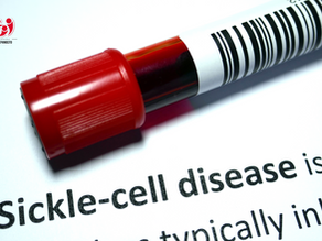 anemia falciforme en perspectiva