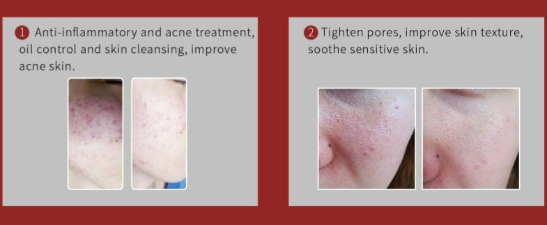 Thumbnail: MicroLift/Tight, MicroBright, MicroClear