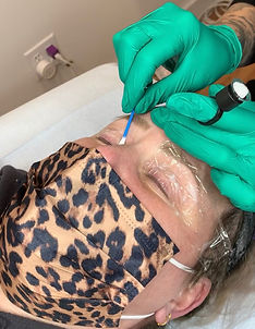 applying numbing cream for permanent eyeliner procedure