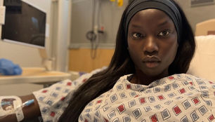 Supermodel Anok Yai Shares She Has Been Quietly Battling A Congenital Heart Condition