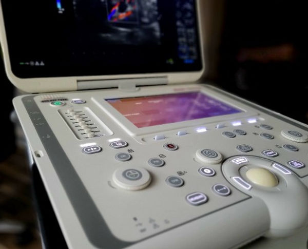 ultrasound machine