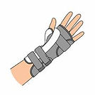 splint.jpeg