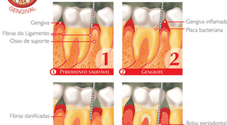 Periodontia