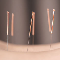 AdobeStock_285161162 (1)_edited.jpg