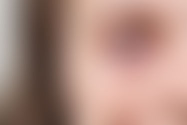 7 Physical Signs You Could Be Suffering Addiction Issues