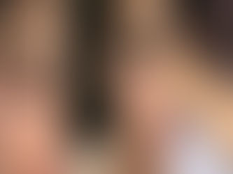 “Moretones, por cirugías estéticas”: Giovanni Medina reaccionó a las fotos de Ninel Conde con marcas