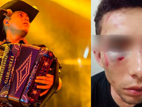 Reportan que Remmy Valenzuela habría huido de México tras orden de aprehensión en su contra