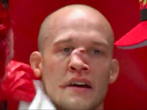 PELADOR DE MMA RECIBE BRUTAL GOLPE QUE LE DESFIGURA LA NARIZ (VIDEO)