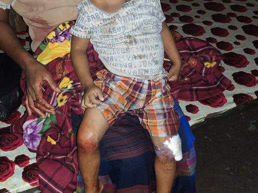 ဖက်ဆစ် အကြမ်းဖက် စစ်ကော်မရှင်မှ အာရက္ခပြည်အနှံ့ စစ်ရေးပစ်မှတ်မဟုတ်သော နေရာများအား ဆက်တိုက်ဗုံးကြဲလျက်ရှိနေပြီး စစ်ရာဇဝတ်မှုများကို ပြောင်ပြောင်တင်းတင်းဆက်လက်ကျူးလွန်နေ