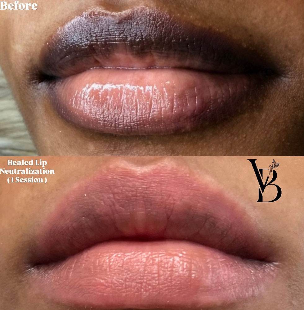 Thumbnail: Lip Neutralization Treatment 