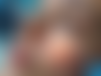 Unveiling the Benefits of Full Face Lifts with PDO Threads for a Youthful Transformation