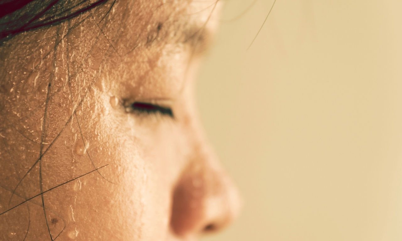 Treatment for excess sweating of face in London Ontario