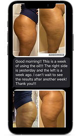 body contouring