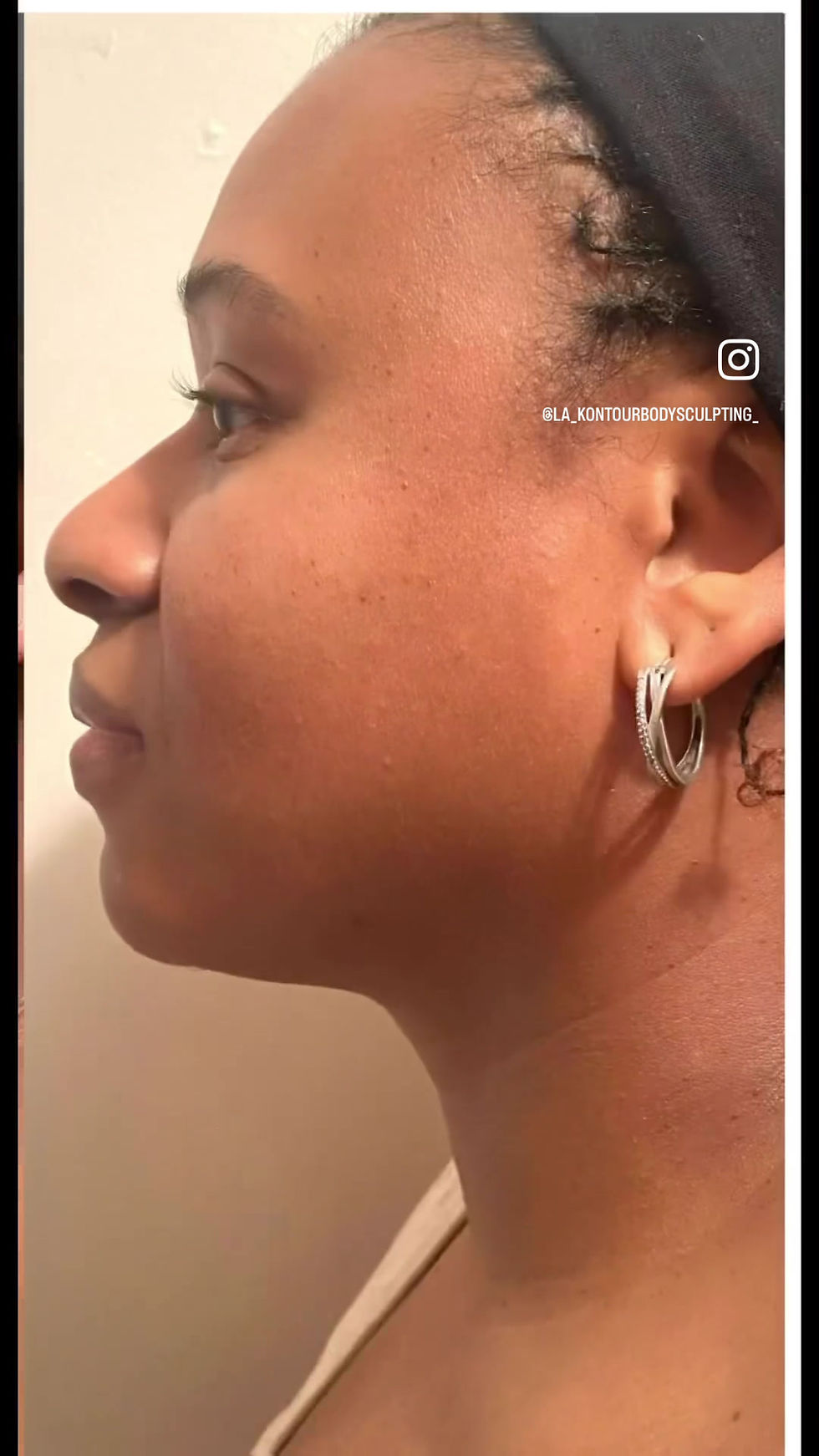 Thumbnail: LK Exfoliating Mask