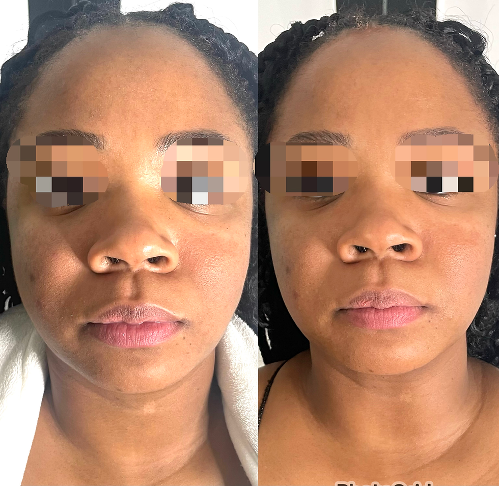Thumbnail: LK Rose Gold  Facial Mask(Hydrate & Glow)