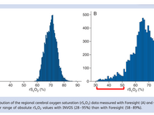 O que o neurofisiologista deve saber sobre NIRS em cirurgias cardíacas