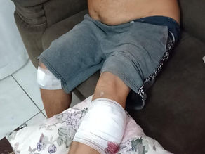 Idoso sofre ataque de três pitbulls no bairro Nassif; afilhada de 5 anos é salva