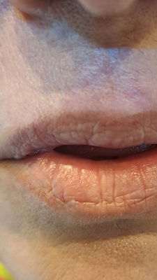 candy lips avant.jpg