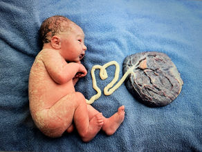 Epidurals in Birth: Understanding What the Whole Story