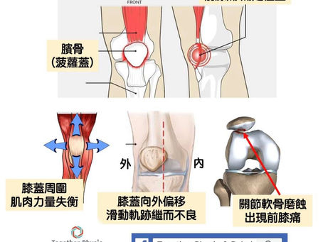 屈埋膝頭就開始痛？已經好耐唔可以蹲低執野？落斜路/樓梯就開始膝頭痛？