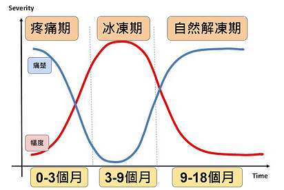 五十肩(肩周炎)的病徵 第一是疼痛期:  這時痛楚問題是最明顯，膊頭無論在靜止期間及活動都會有痛楚，而且痛楚也會嚴重影響晚上睡眠質素。  這會持續大約2-9個月。    第二：冰凍期  痛楚開始逐漸減少，但膊頭會變得僵硬，這我們稱為 凝肩 病人會未能抬高手，或者尤其是手向後拗背的活動能力，或手向後伸展等等。  這會持續大約4-9個月。    第三：自然解凍期  膊頭活動能力會慢慢自然恢復，但膊頭關節在活動最盡位置仍然會有限制。  時間大約在第12-18個月。所以，肩周炎患者通常痛楚的時間由發病開始計，通常需要一年時間而令到膊頭復原。 但膊頭的康復程度及進度則視乎於在疼痛期及冰凍期的時候，是否有接受物理治療及時處理問題。