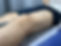 Meniscus Injury.jpeg