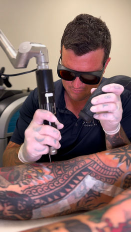 Laser Tattoo Removal Tech Toowoomba 