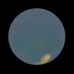 Keeping that sperm warm