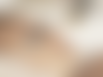 Revitalize Your Skin with Laser Genesis at Skin + Body by Smooth Med: The Ultimate Solution for Acne Scars, Melasma, and More