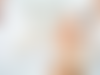 Botox vs. RHA Filler: Understanding the Differences, Uses, and Benefits