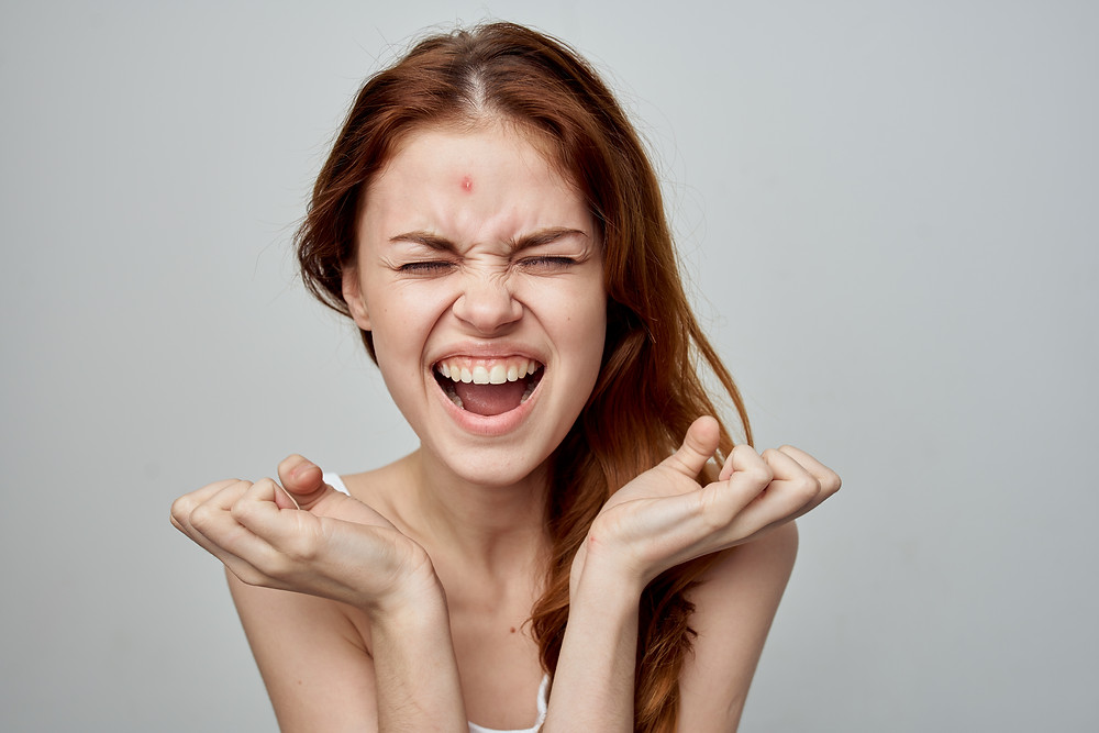 what to do if I have a lot of acne