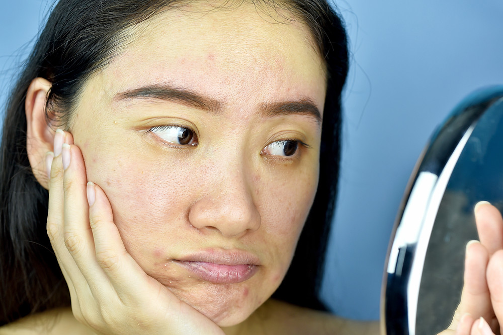when should you exfoliate your skin