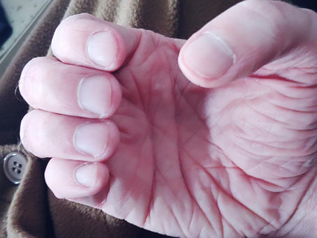 Fingernails