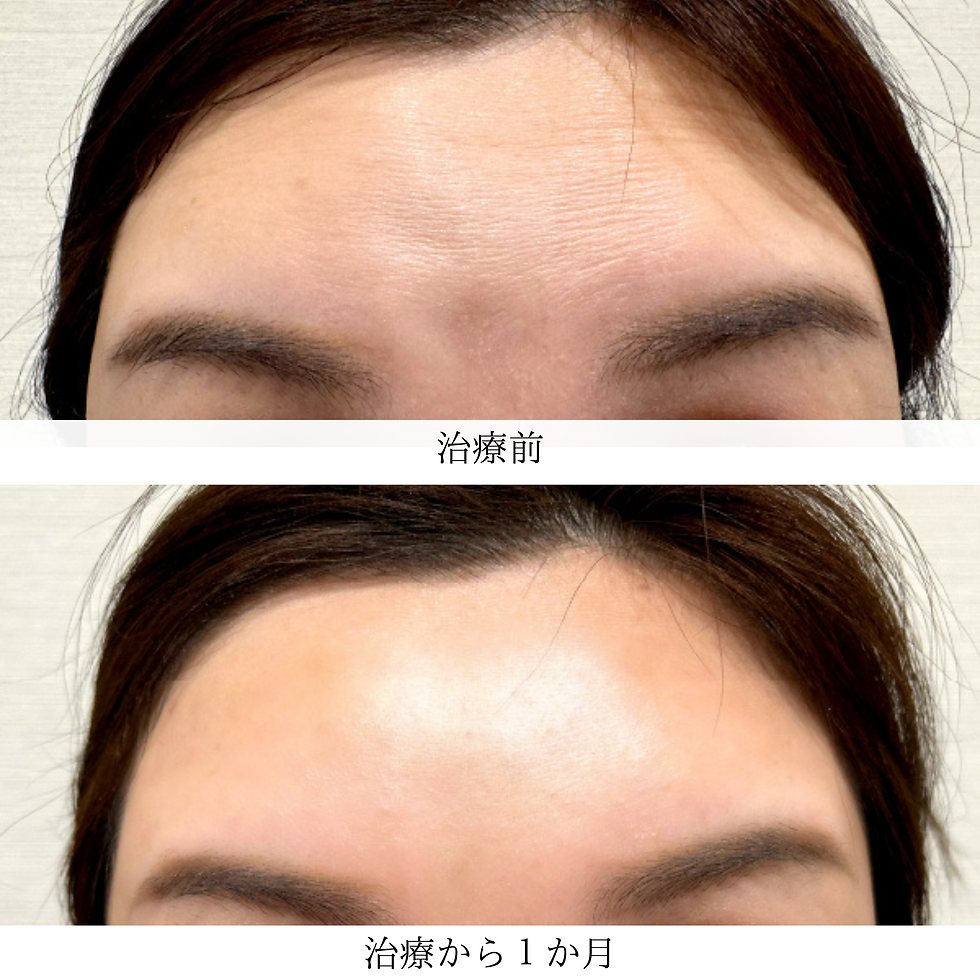 Hair removal (22).png