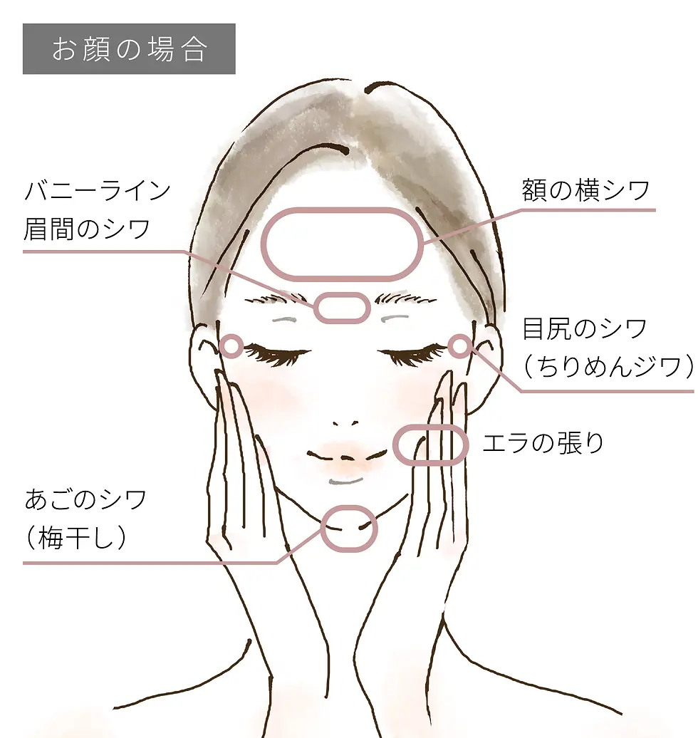botox_02_01.webp