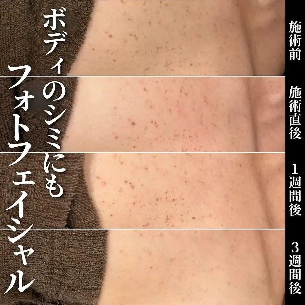 body.webp