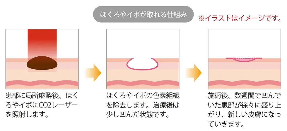 hokuro2.webp