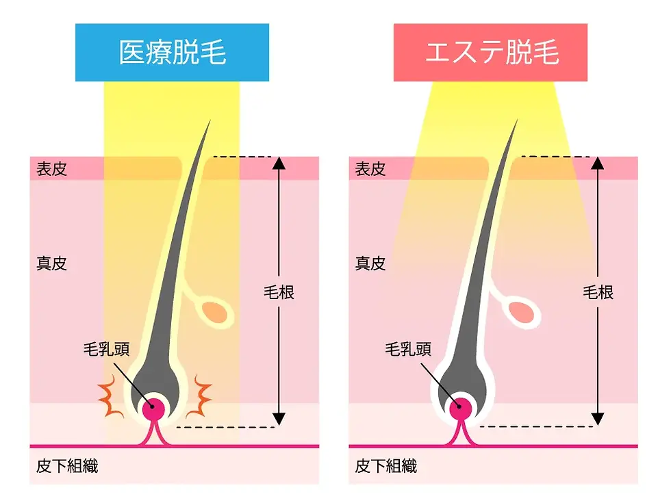 datsumo7 (1).webp