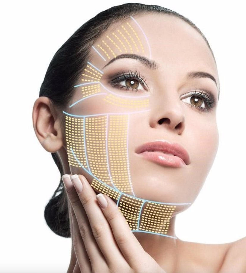 HIFU Treatment in Islamabad