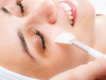 A Dermatologist’s Guide to Chemical Peeling in Islamabad