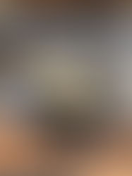 新オプションパーツ『TENPI』