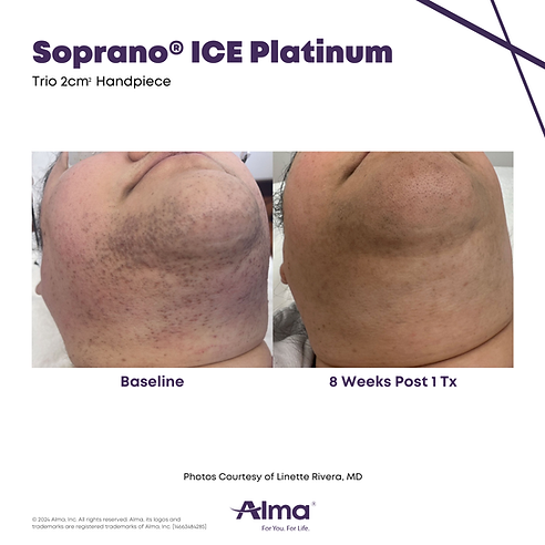 Soprano_Platinum_BA_L.Rivera_Q3-24_14663484285_Canva.png